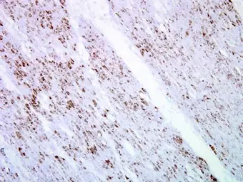 Anti-SMAD4 antibody used in IHC (Paraffin sections) (IHC-P). GTX112980
